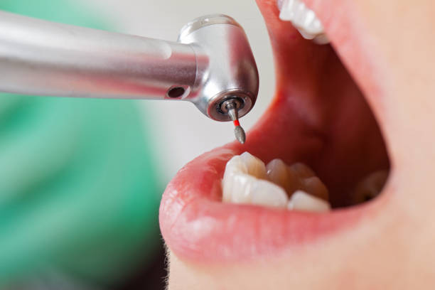 Best Emergency Dental Care for Sports Injuries in Hoopers Creek, NC